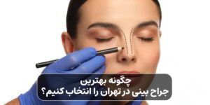 بهترین جراح بینی در تهران
