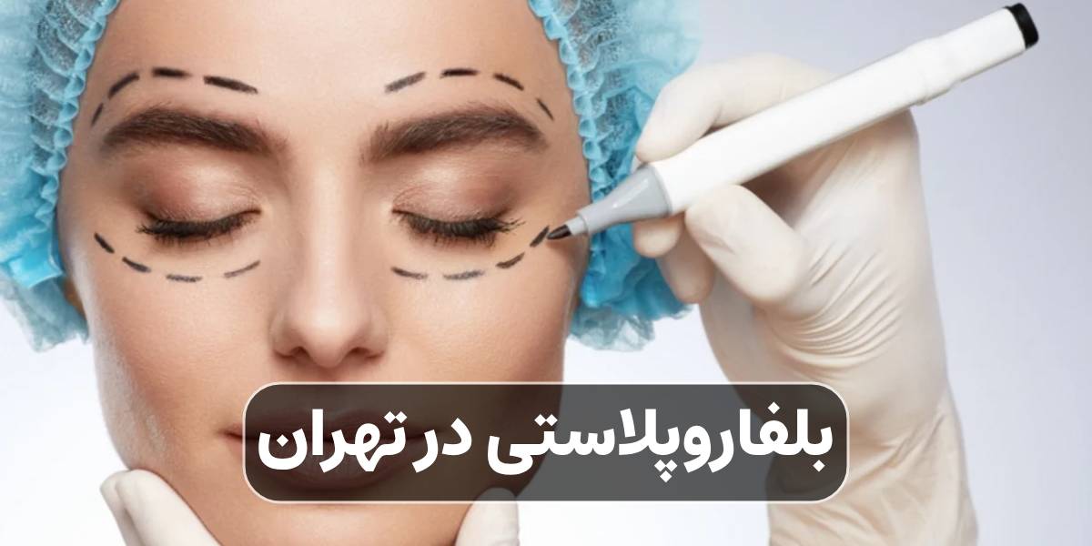 بلفاروپلاستی در تهران