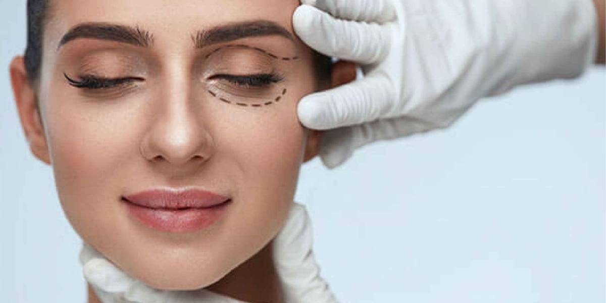 جراح پلک در تهران