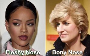 تفاوت بینی استخوانی و بینی گوشتی