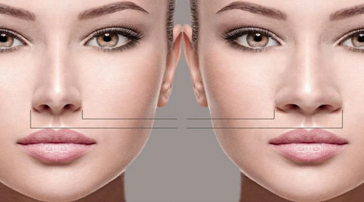 عمل بینی استخوانی و گوشتی: چه تفاوت ‌هایی وجود دارد؟