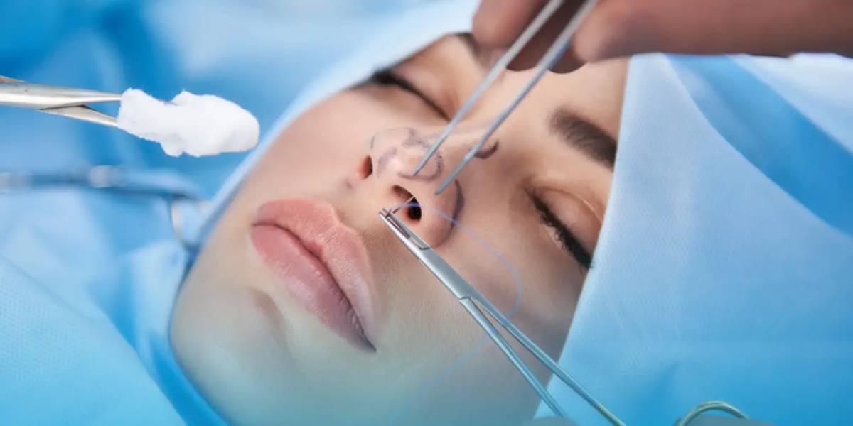 نحوه انجام عمل بینی باز و بسته