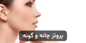 پروتز چانه و گونه چیست