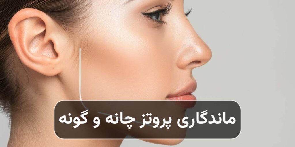 ماندگاری پروتز چانه و گونه