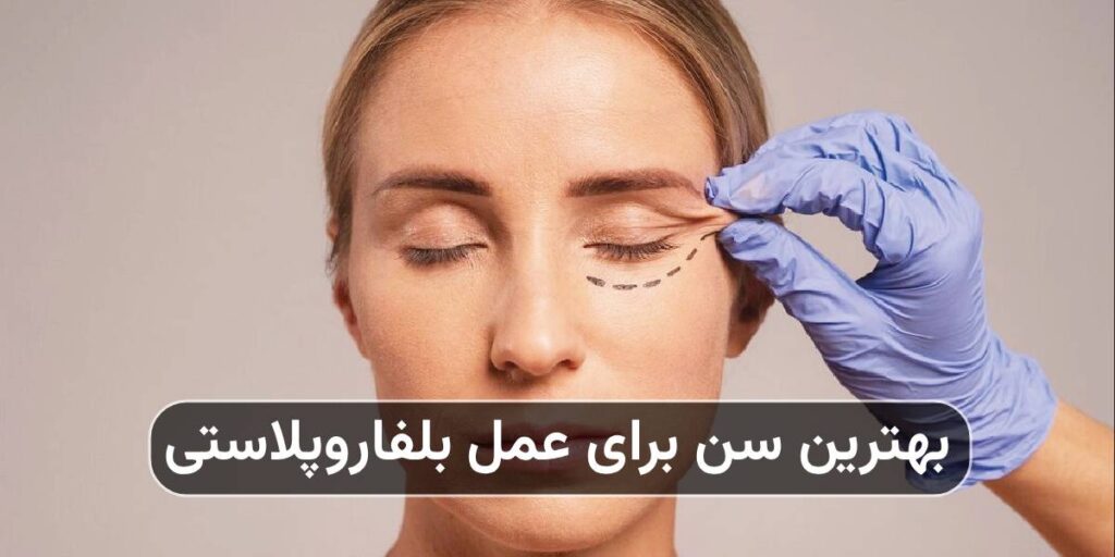 بهترین سن برای عمل بلفاروپلاستی