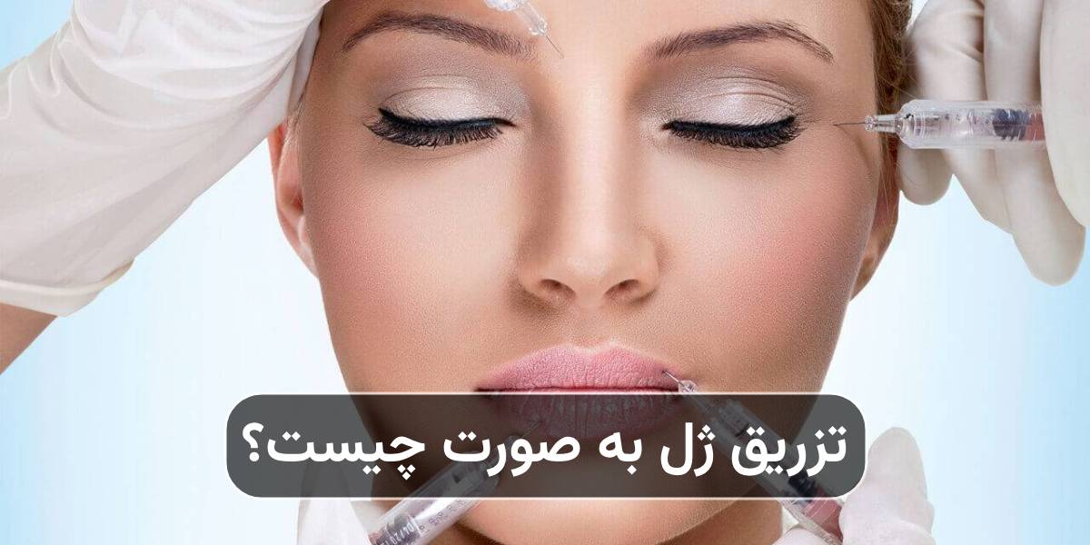 تزریق ژل به صورت چیست