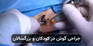 جراحی گوش در کودکان و بزرگسالان