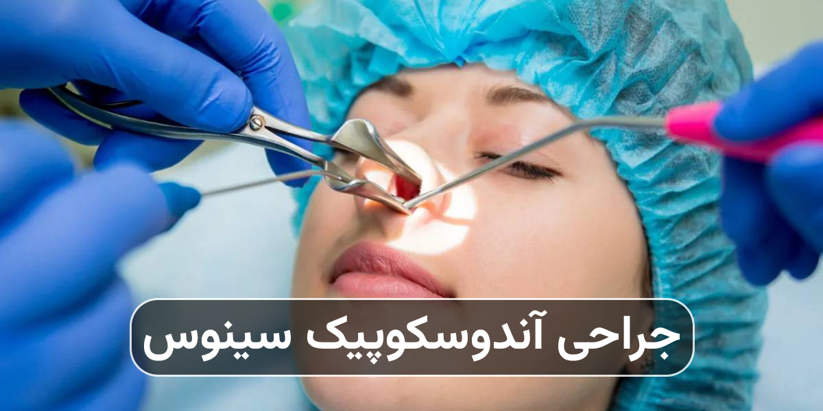 جراحی آندوسکوپیک سینوس چیست