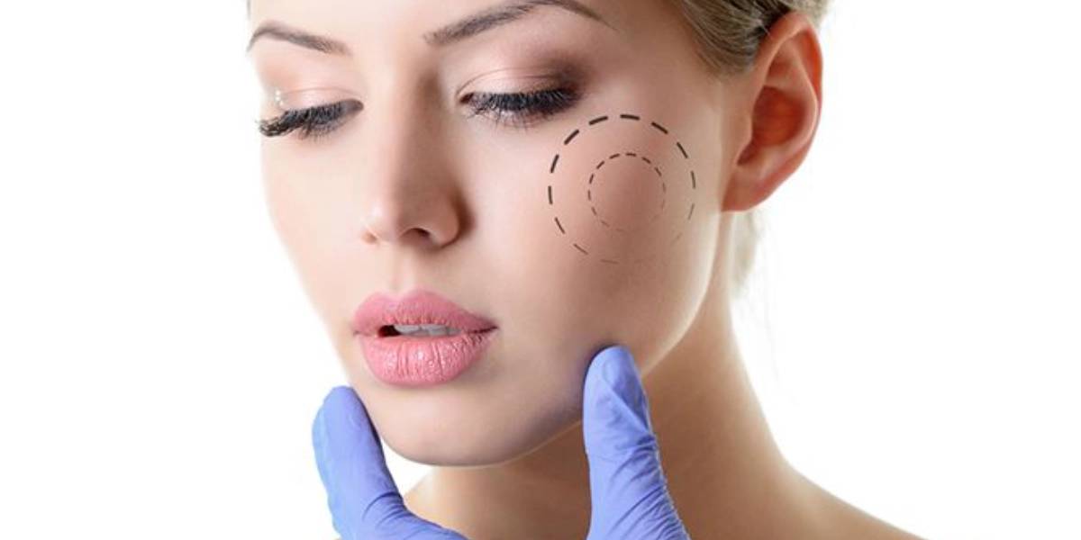 ماندگاری پروتز چانه و گونه