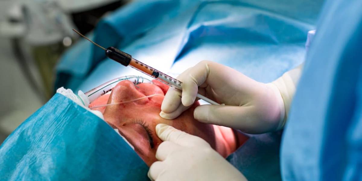 هزینه تزریق چربی به صورت