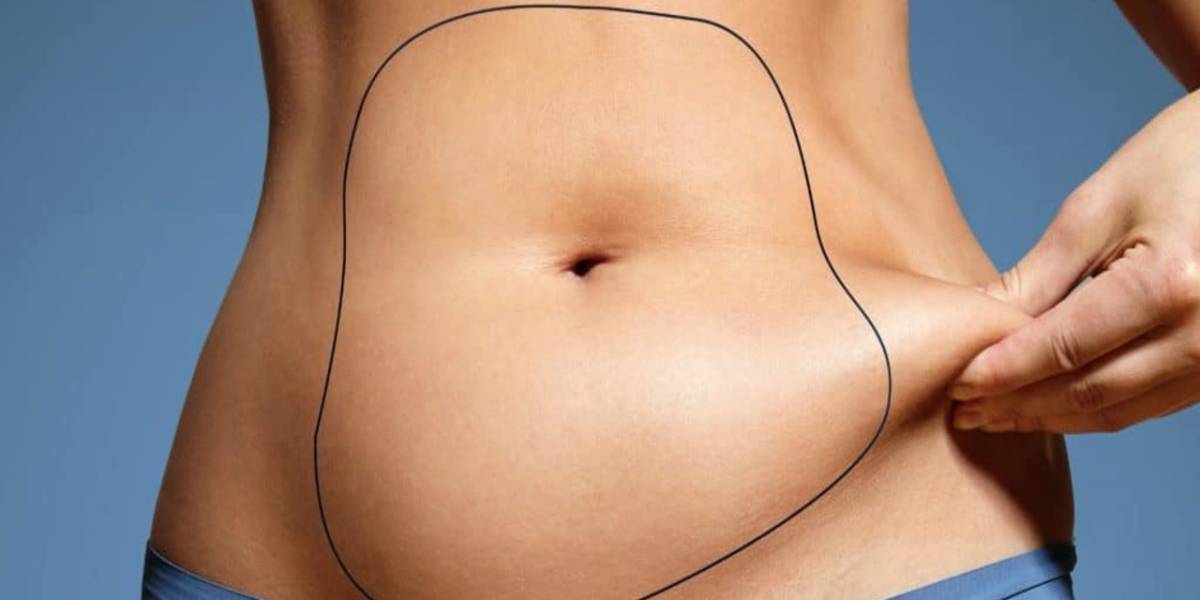 لیپوساکشن چیست