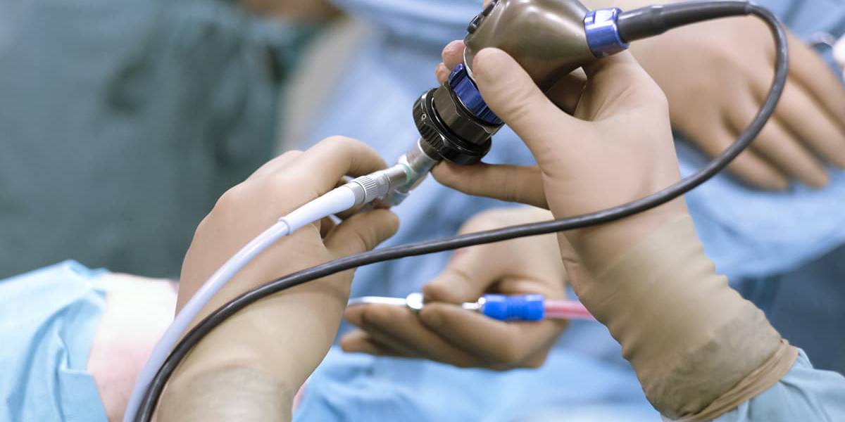 مزایای جراحی آندوسکوپیک سینوس